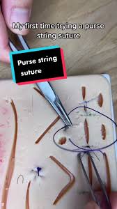 Image result for Purse String Suture