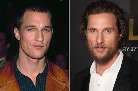 Thankfully, more women than ever before are coming together. 10 Male Celebrities Who Were Losing Hair Concealed Their Baldness Completely Lipstiq Com