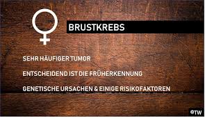 Doktorweigl Erklart Knoten In Der Brust Brustkrebs Mammakarzinom Ursachen Therapie Vorsorge