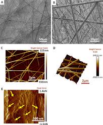 We did not find results for: Frontiers Electrospun Nanofiber Meshes With Endometrial Mscs Modulate Foreign Body Response By Increased Angiogenesis Matrix Synthesis And Anti Inflammatory Gene Expression In Mice Implication In Pelvic Floor Pharmacology