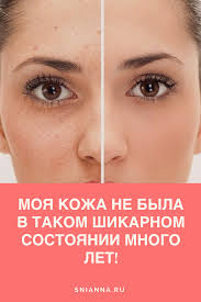 как убрать черные точки на носу в домашних условиях 10 Prostyh Effektivnyh Sovetov Blagodarya Kotorym Ty Vsegda Budesh Vyglyadet Na Vse 100 Uhod Za Kozhej V D Produkty Dlya Lica Priemy Dlya Krasoty Maski Dlya Lica