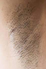 Dolor En La Axila Causas Comunes Y Tratamientos