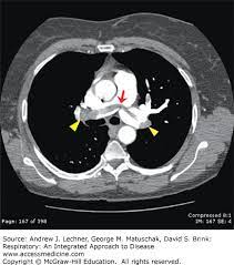 Ct Scan Ppt Free Download Ct Scan Machine