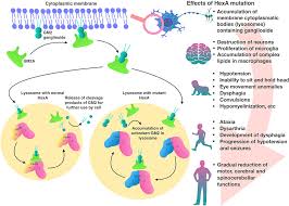 frontiers new approaches to tay sachs disease therapy