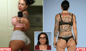 Relax your eyes for a few seconds. Exotic Dancer Reveals Saggy Misshapen Butt After Injections Issue Daily Mail Online