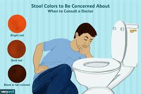 stool color changes whats normal and whats not