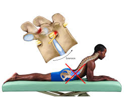 Image result for Low Back Standing Exam