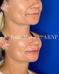 Bellora Medical Aesthetics