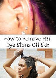 Every Time You Dye Your Hair At Home You Confront With Hair Dye Stains Find Out How To Remove Hair Dye Stains Off Skin Hair Dye Removal Hair Stain Box Hair Dye