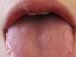 Professor spector is urging anyone who experiences lesser known symptoms, like covid tongue, to isolate, acting as if it is indeed a. Expert Warns Of Common New Covid 19 Symptom To Look Out For Chronicle Live