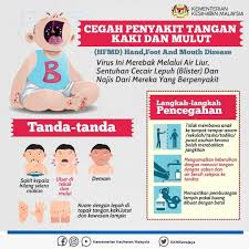 Menutup mulut dan hidung apabila batuk dan bersin. Penyakit Tangan Kaki Dan Mulut Portal Rasmi Majlis Bandaraya Iskandar Puteri
