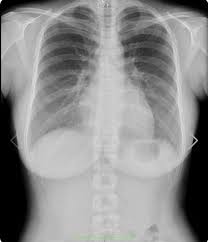 レントゲン エロ画像！X線写真に仰天！ | エロ画像エロ寺 - 抜けるお宝画像まとめサイト