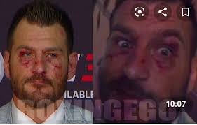 It's Time!! Stipe Miocic vs Daniel Cormier is LIVE right now at #UFC252!!