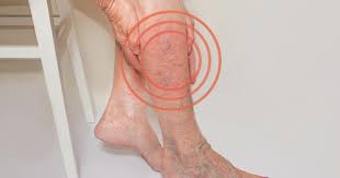 We did not find results for: Blood Vessel Symptoms Symptoms Causes Treatments