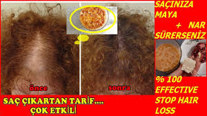 Sac Costuran Tarif Nar Ve Maya Ile Sac Dokulmesine Son Hizlisacuzatma Saccikartantarif Easydiy Youtube