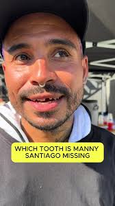 ¿Qué diente le falta a Manny Santiago?