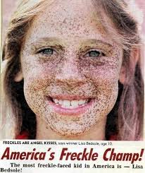 America's freckle champ! : r/pics