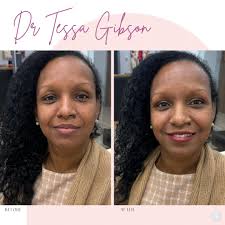 Women needed for virtual skin care sessions