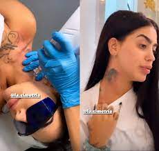 MC Mirella remove tatuagens em homenagem ao ex-marido, Dynho Alves, diz colunista - Estrelando