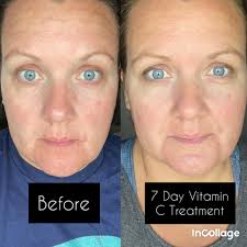 Review of Dr.Perricone MD Cosmeceuticals product by BzzAgent