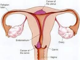 Cancer signals in both men and women. Cervical Cancer