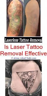 Signs of a tattoo ink allergy include raised skin, bumps and blisters, patchy and flaky skin and watery discharge from the tattooed area. Pin On Tattoo Removal