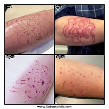 Ten Simple But Important Things To Remember About How Much Are Henna Tattoos Near Me How Much Are H Tattoo Removal Cream Tattoo Removal Tattoo Removal Cost