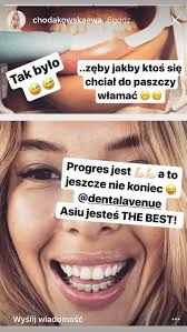 See more of ewa chodakowska on facebook. Ewa Chodakowska Zeby Jakby Ktos Sie Chcial Do Paszczy Wlamac Foto Zeberka