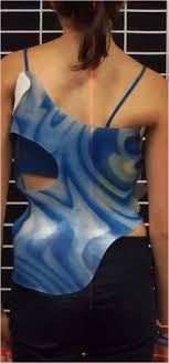 علاج انحناء العمود الفقري