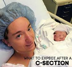 I Ve Had 4 C Sections And Today I M Sharing What To Expect After A C Section These Are The Things I Wish Someone Had Shared With Me Befo C Section New Baby Products