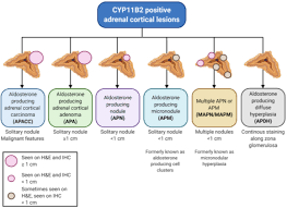 Image result for Aldosterone