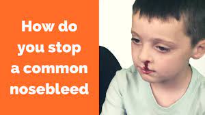 How To Stop A Nosebleed? (Do's And Don'ts) - Youtube