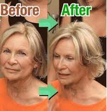 Thinning Hair At The Top Of Your Head Cover It Up With This Magic Hair Topper Clip Shop Now Hair Toppers Magic Hair Hairstyles For Thin Hair