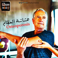 مرض هشاشة العظام أو العظام المنخورة يعني بيكون العظام وصلت لمرحلة من الضعف عالية جدا لدرجة إنها بتكون هشه عشان Fictional Characters Movie Posters Osteoporosis