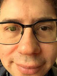 Did I do it right? #vanityfair #iykyk #doctor