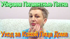 как убрать пигментные пятна на лице в домашних условиях Ubiraem Pigmentnye Pyatna Uhod Za Kozhej Lica V Domashnih Usloviyah Lico Uhod Za Kozhej Uhod Za Kozhej Lica