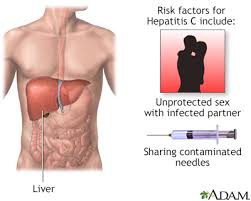 Oct 25, 2018 · additional key facts about the hepatitis c virus from the cdc include: Hepatitis C Information Mount Sinai New York