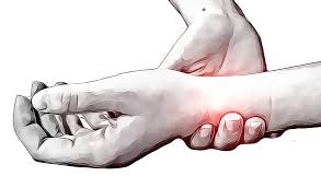 See sprained wrist stock video clips. Wrist Sprains Rural Physio At Your Doorstep