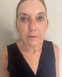 Olive Tree Medical Spa