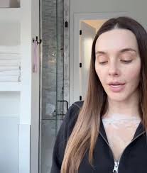 She will never convince me that she doesn't use fillers… :  r/theskinnyconsnark