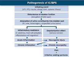 Image result for Dysuria