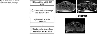 Flow Chart Of The Fatsubtracted Mra Technique Download