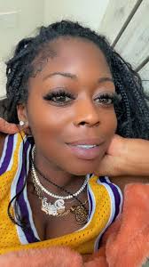 Free Makeovers for Alopecia Sufferers to Boost Confidence