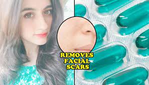 Evion 400 mg vitamin e capsule for skin whitening and hair growth benefits and side effects. 6 Unheard Benefits Of Evion Vitamin E Capsule That Will Enhance Your Beauty In No Time