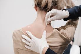 Comprehensive Skin Checks and Mole Checks: Protect Your Skin's Health Today