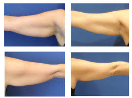 Pin On Sydney Cosmetic Plastic Surgery