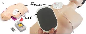 Certain defibrillators have special controls for internal paddles or disposable electrodes. Plos One Development Of Defibrillation Simulator With Lc Tank Type Inductance Coupling Position Measurement System