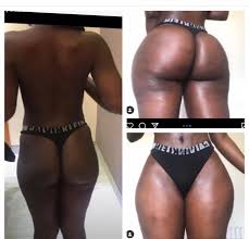 Mia aesthetics abdominal board was designed with wings to wrap around the waist for additional shaping of the abdomen. Stef On Twitter Kosmetickrys This Is Perfect Omg Twitter