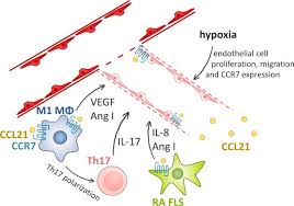Function, proteins, disorders, pathways, orthologs, and expression. The Pathogenic Importance Of Ccl21 And Ccr7 In Rheumatoid Arthritis Sciencedirect