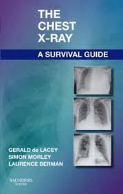 The Chest X Ray A Survival Guide 2008 Gerald De Lacey Simon Morley Laurence Berman Print Available At Lee Wee Nam Survival Guide Medical Library X Ray